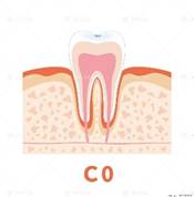 C1