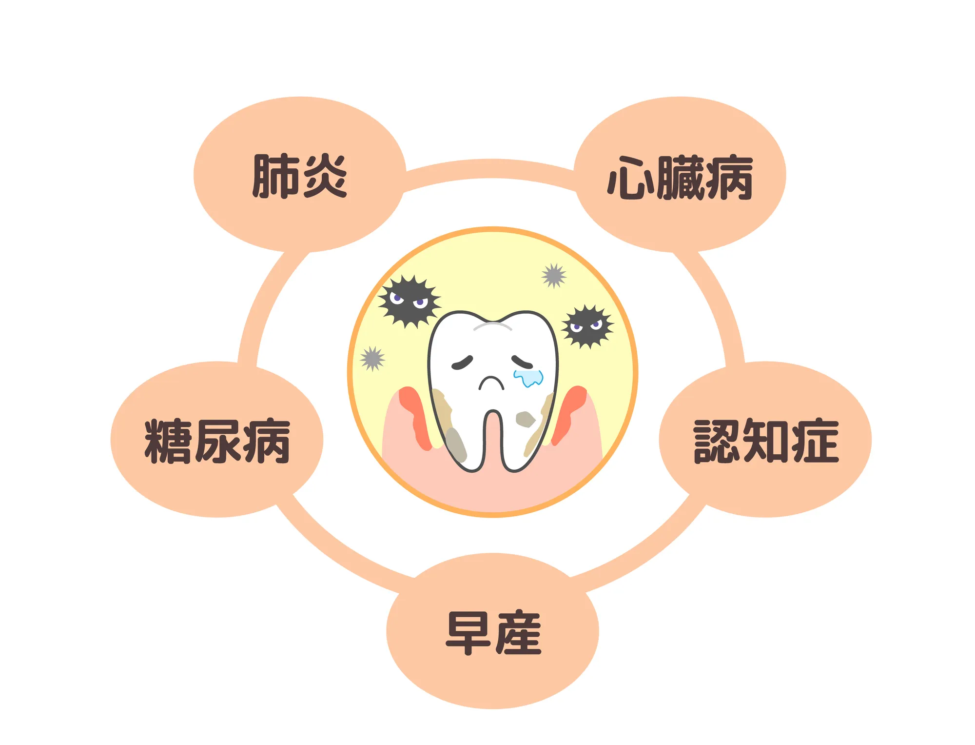 全身疾患との関係